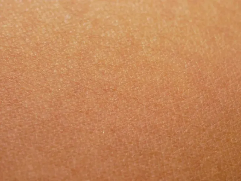 tratamiento machas fisioterapia dermatofuncional adeje